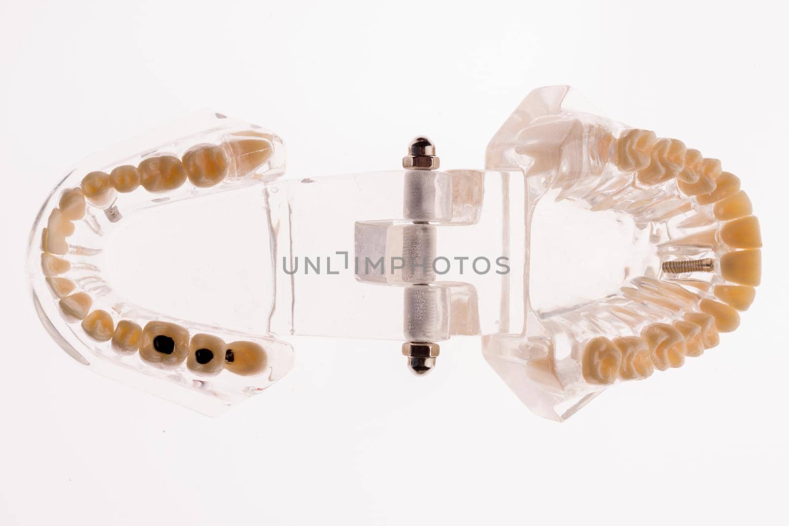 Transparent dentures jaw layout on a white background - image