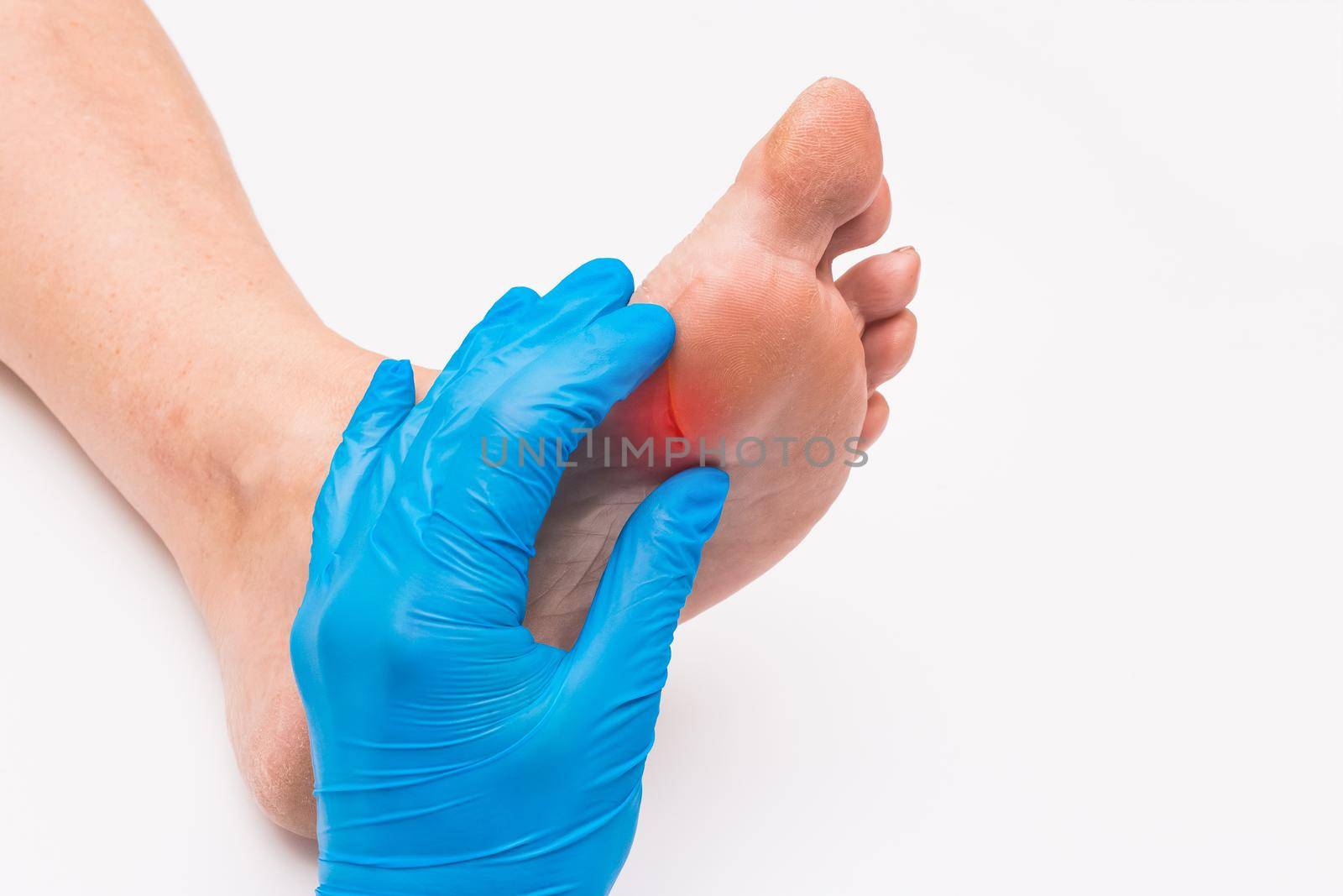 Doctor's hand in a protective medical glove touches and examines the wound on the foot of an elderly woman on a white background.