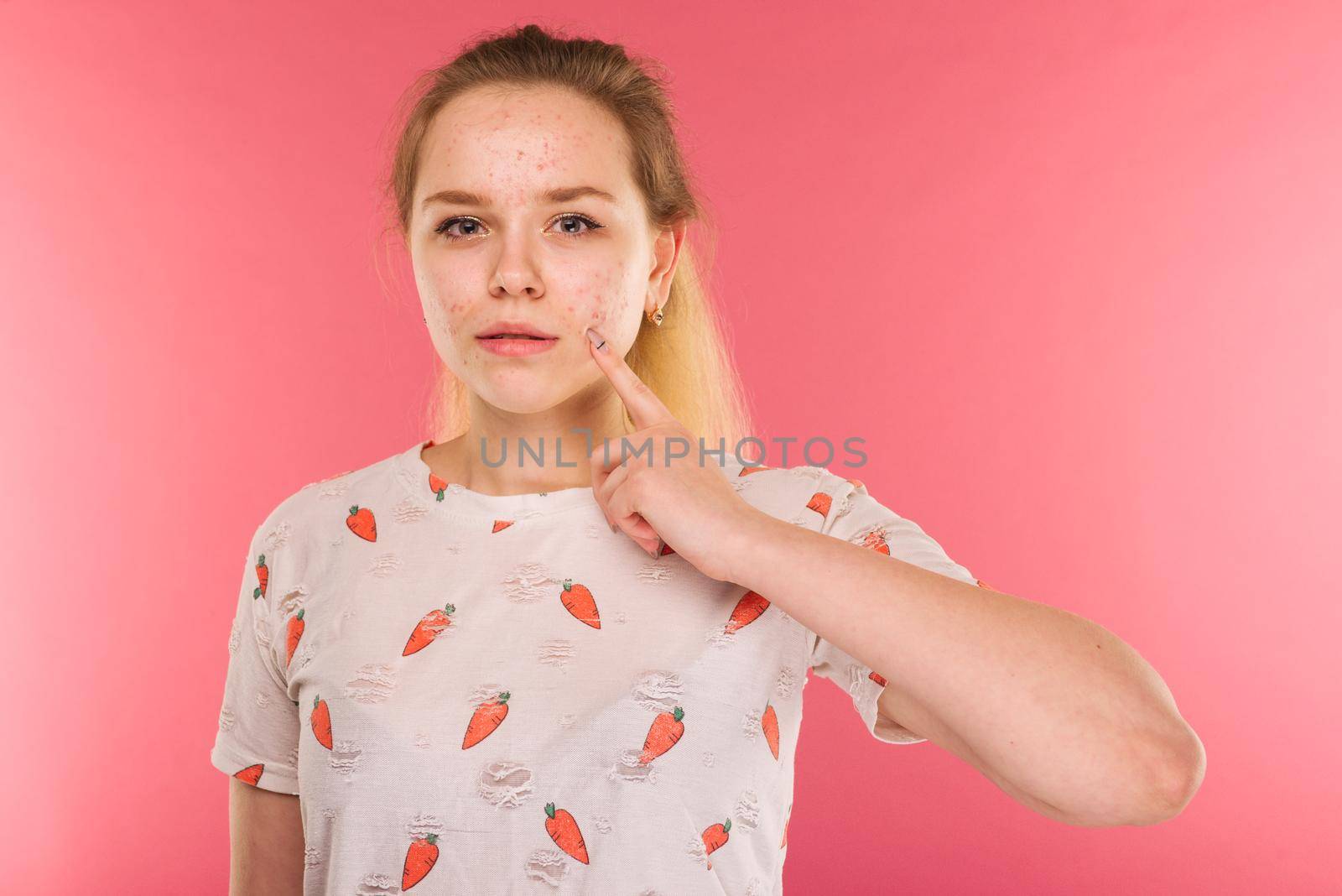 Portrait of teen girl touching her face and looking for acne on ruby background