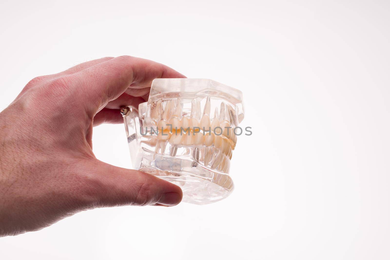 Dentist holding dentures jaw layout on a white background - image