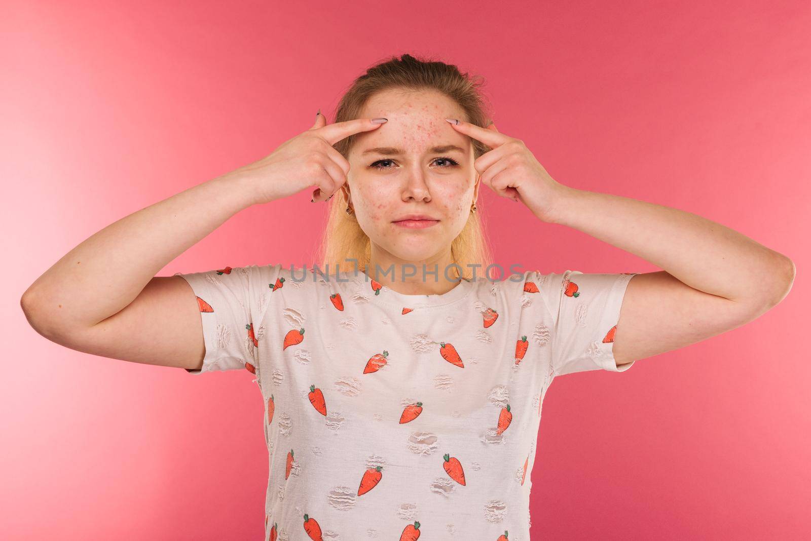 Portrait of teen girl touching her face and looking for acne on ruby background