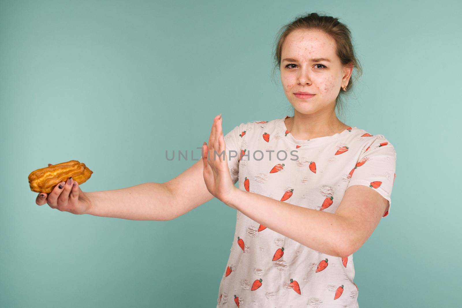 Portrait of pimply teen girl hows hands stop on a delicious cake on blue background