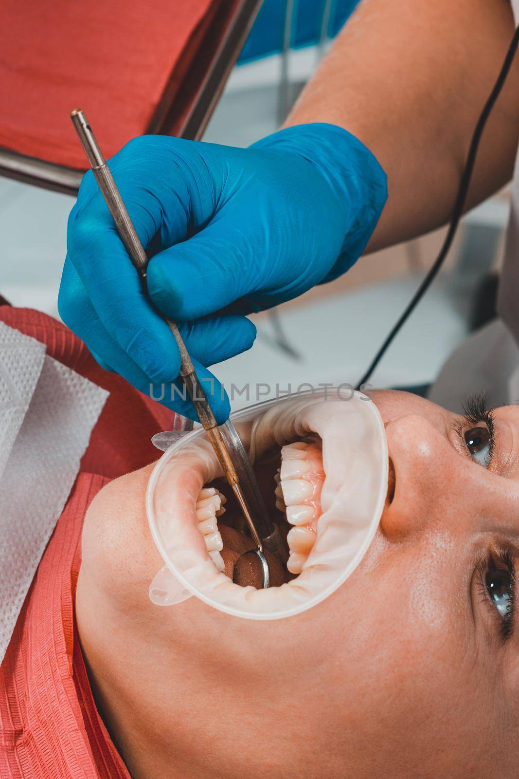 Oral hygiene, a woman at the dentist's office, the use of a retractor while brushing teeth from tartar. by Niko_Cingaryuk