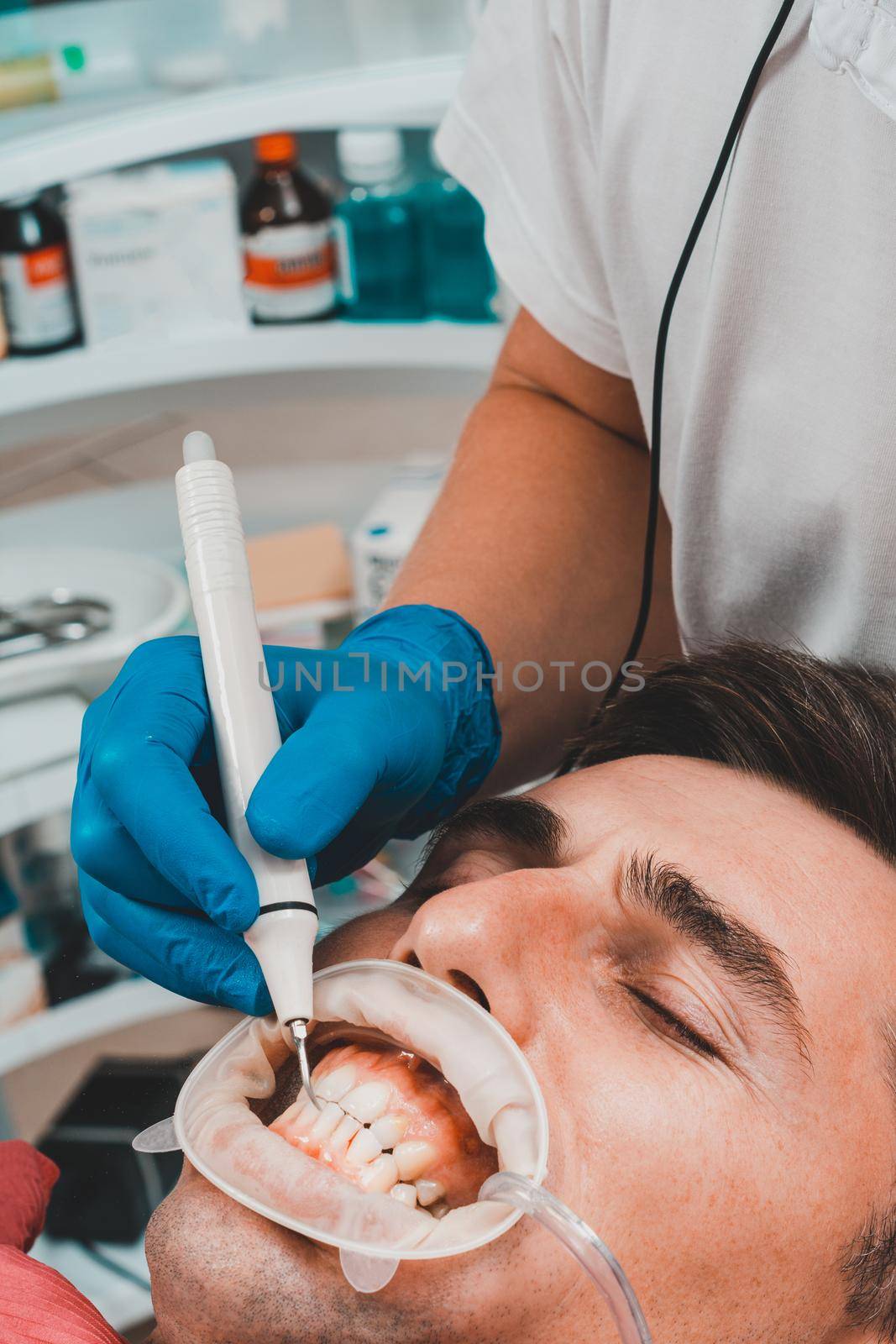 Dental practice, the dentist removes stones and hard plaque from the teeth with the help of ultrasound,patient with retractor and saliva ejector in the mouth.2020