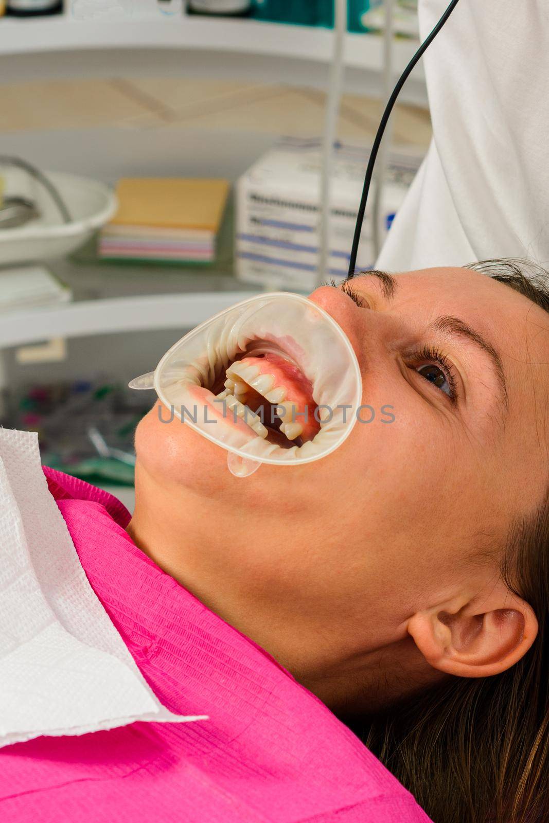 Oral hygiene, a woman at the dentist's office, the use of a retractor while brushing teeth from tartar. by Niko_Cingaryuk