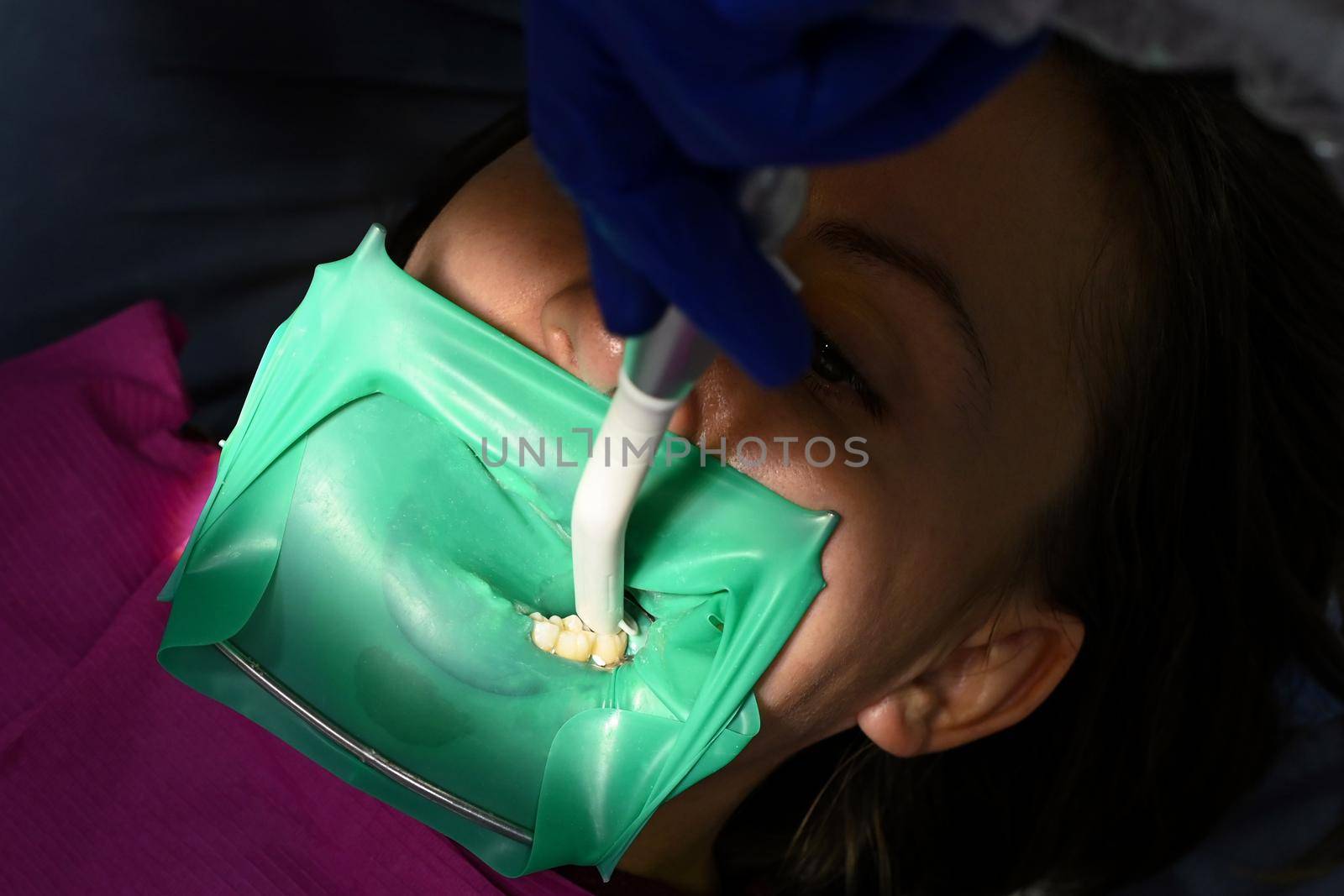 A woman at a dentist's appointment, a dentist uses a rubber dam and dental tools for treatment.2020