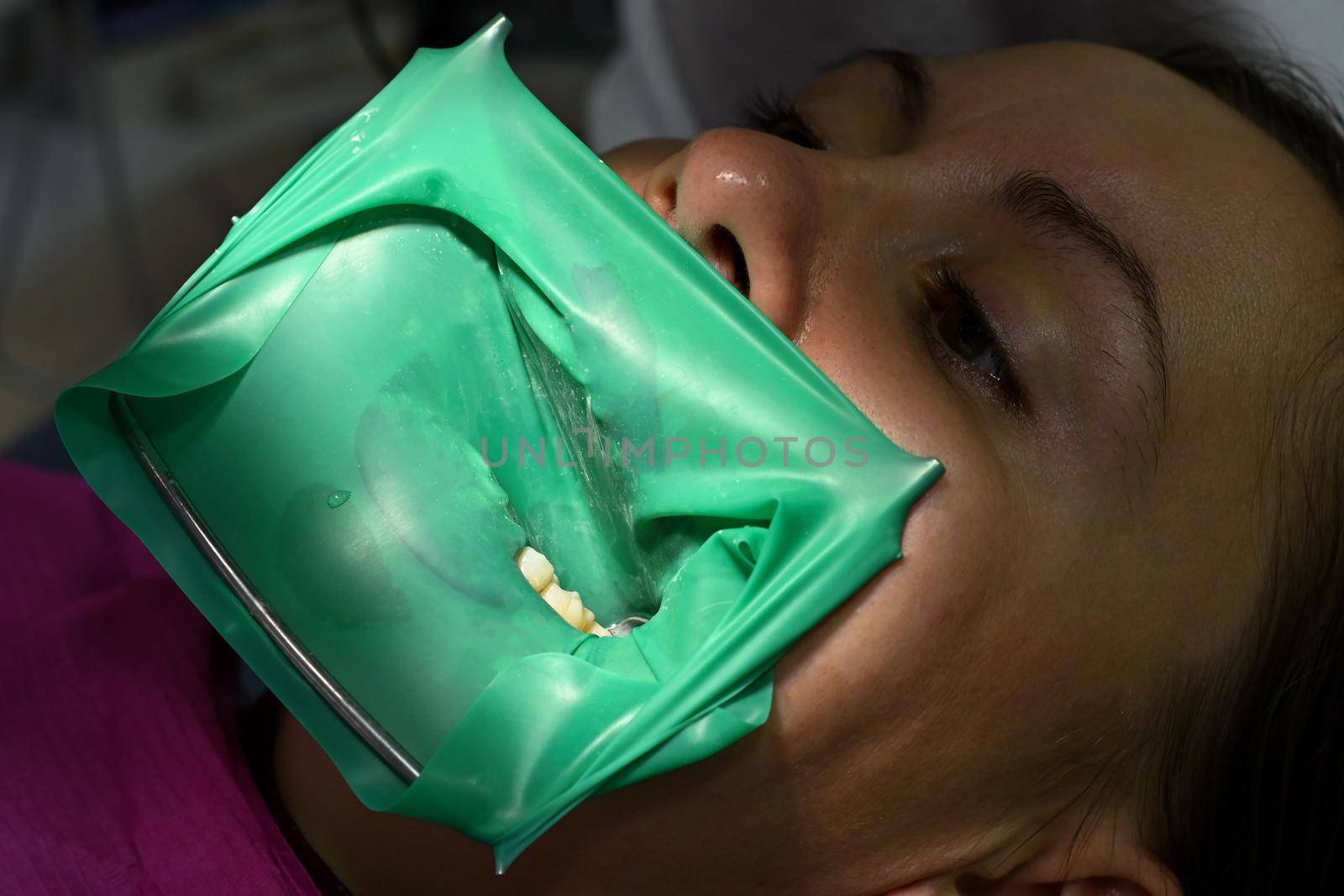 A woman at a dentist's appointment, a dentist uses a rubber dam and dental tools for treatment. by Niko_Cingaryuk