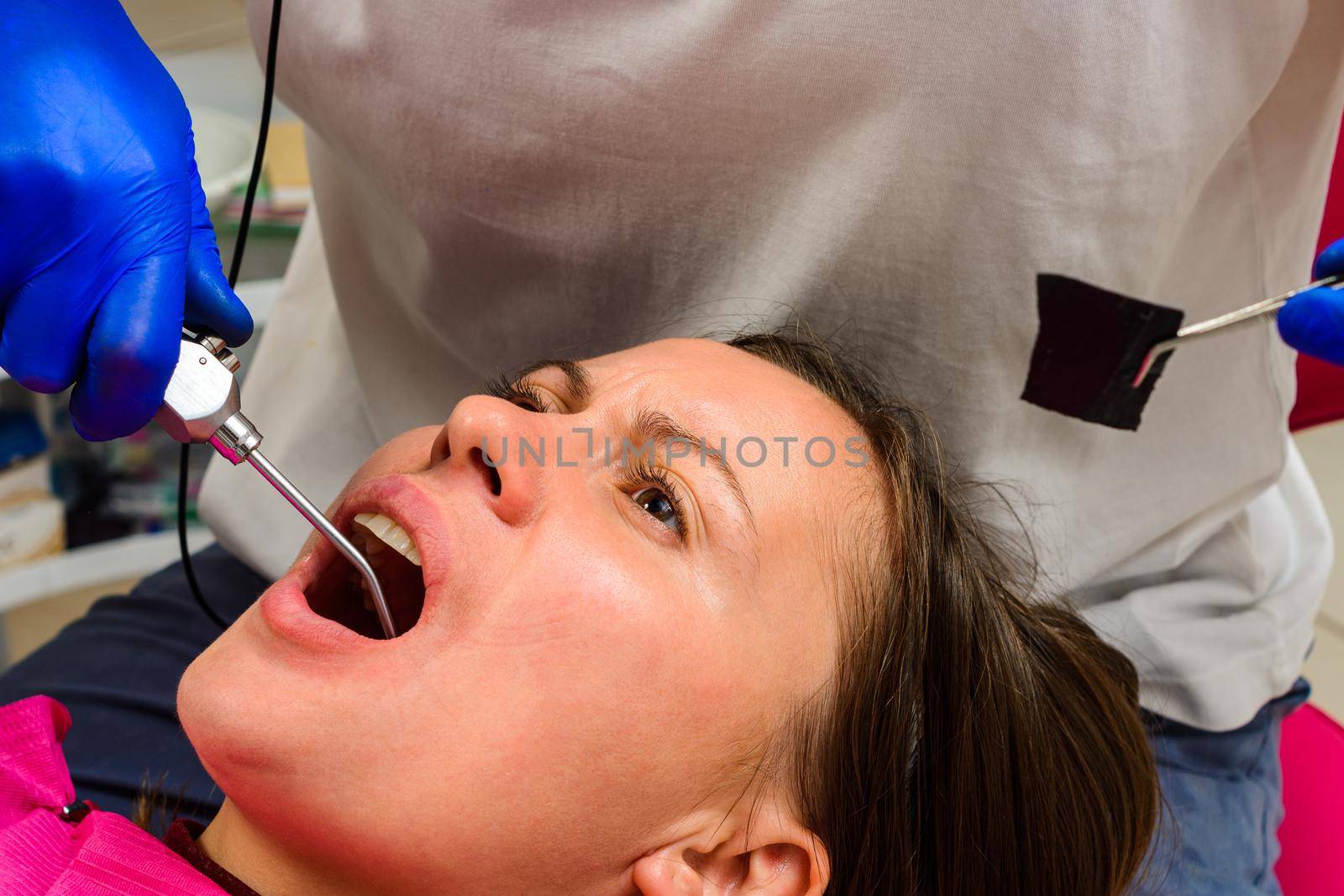 The dentist washes the tooth treatment site with water, washes away the blood and tooth debris.2020