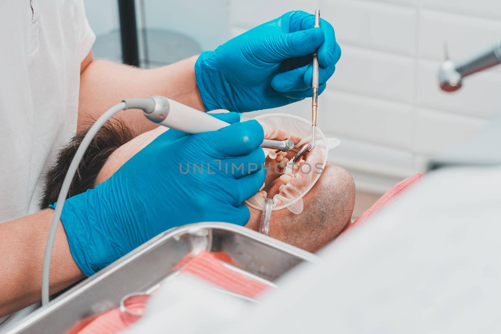 patient removing tartar,the dentist uses ultrasound to remove tartar,dental scaler.2020