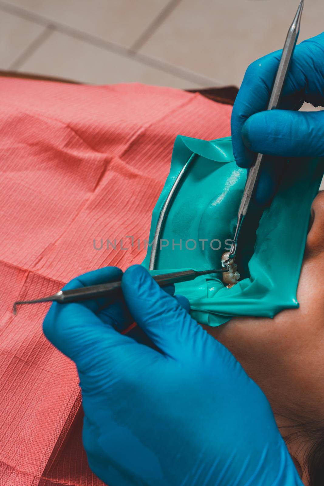 The dentist installs a rubber dam, sterile dental treatment, modern equipment in dentistry. by Niko_Cingaryuk