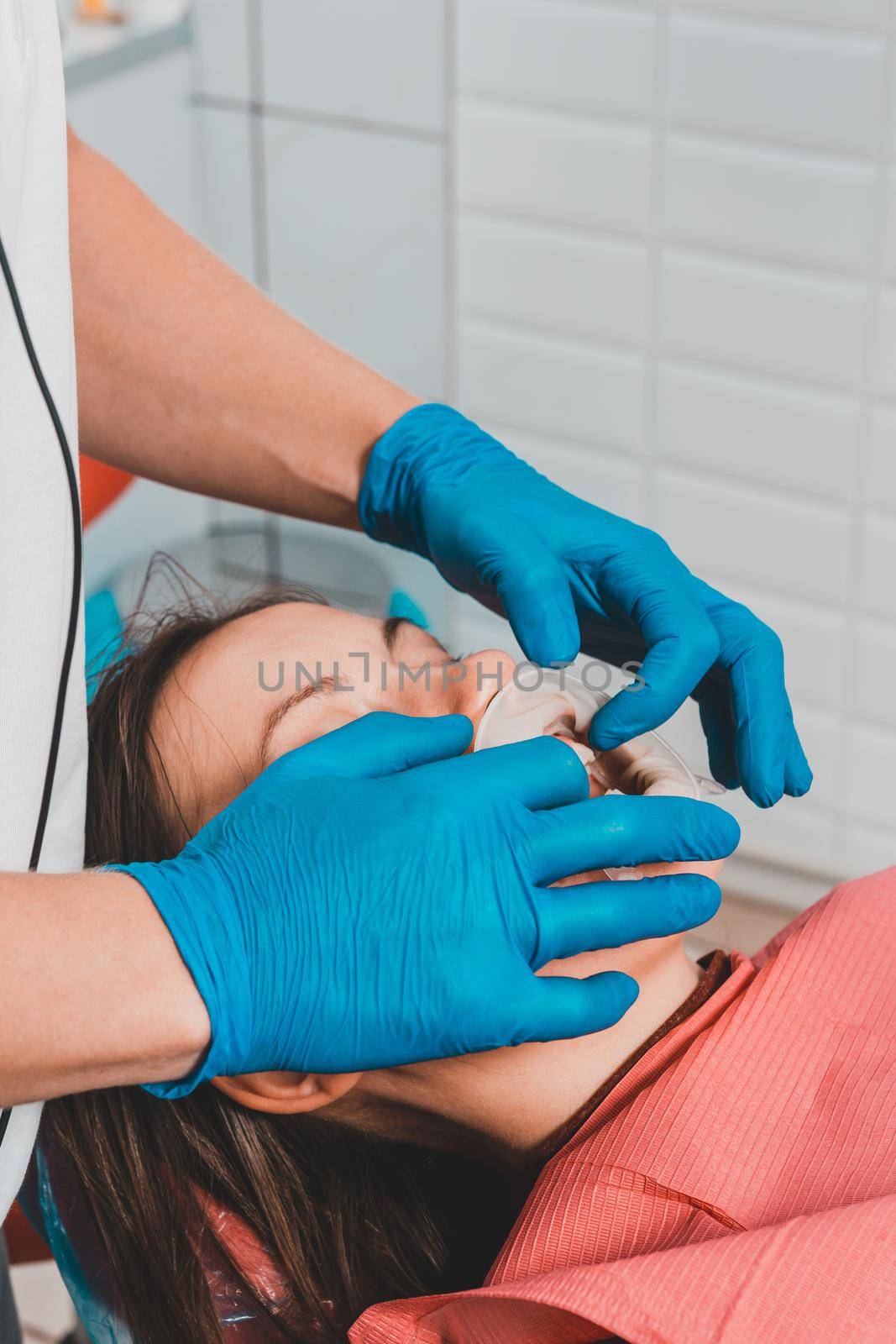 The dentist prepares the patient for the procedure of tartar removal by ultrasound, on the lips of the patient's retractor.2020