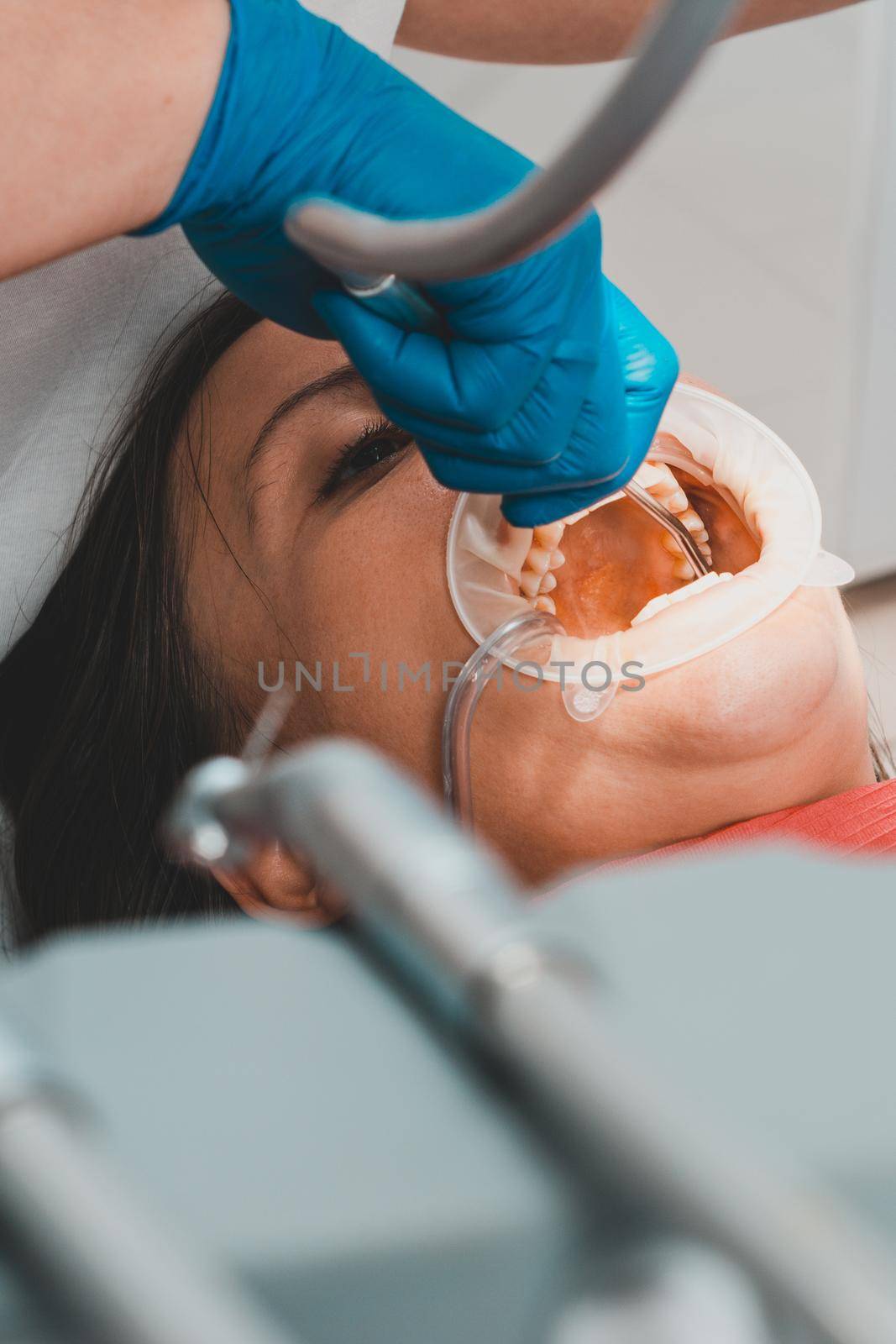 After cleaning the teeth from tartar, the dentist rinses them with water, using only sterile instruments. by Niko_Cingaryuk