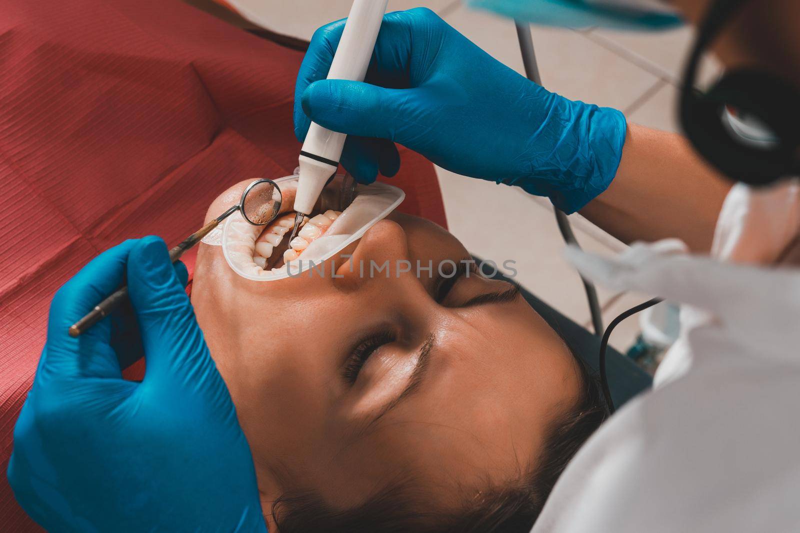 At the dentist's appointment, tartar removal, use of ultrasound, patient and dentist. Retractor for isolation of lips and gums. by Niko_Cingaryuk