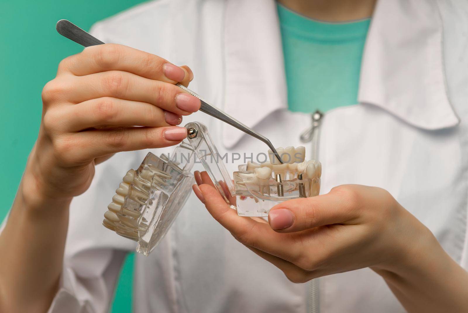 Woman dentist showing on a jaw model oral checkup - image