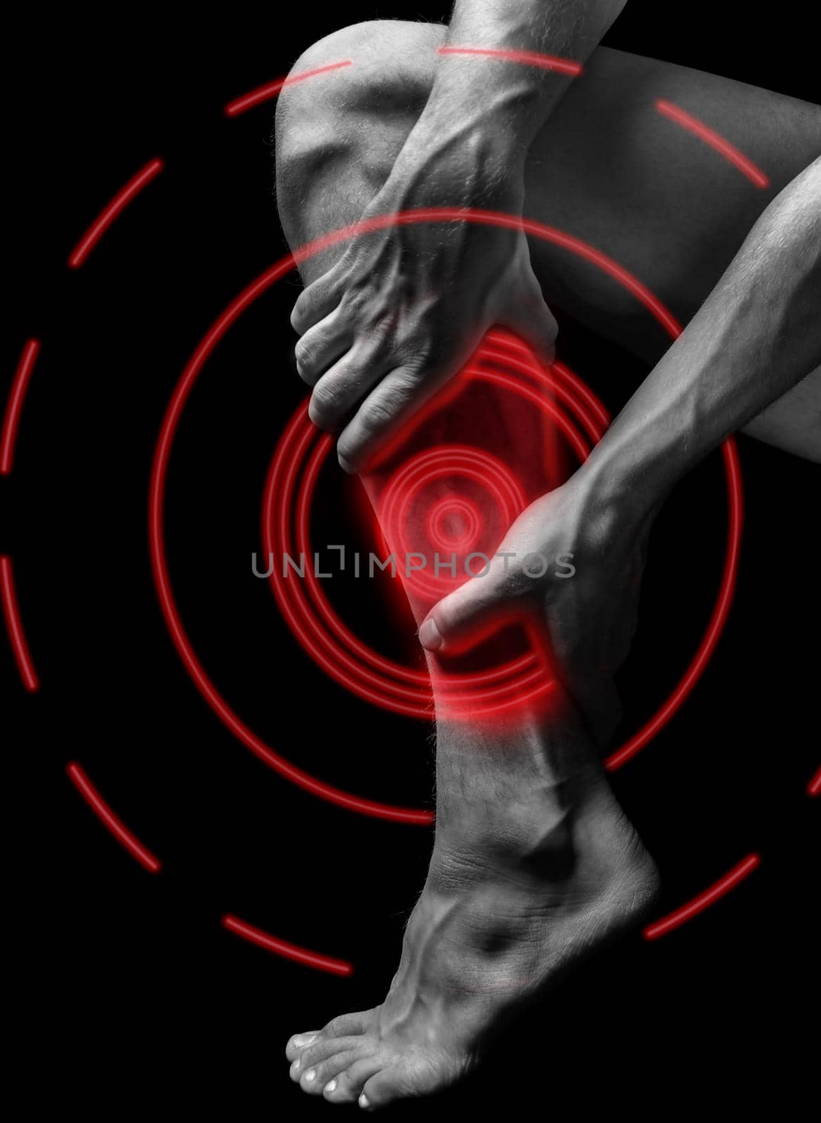 Acute pain in the male calf muscle, black and white image, pain area of red color