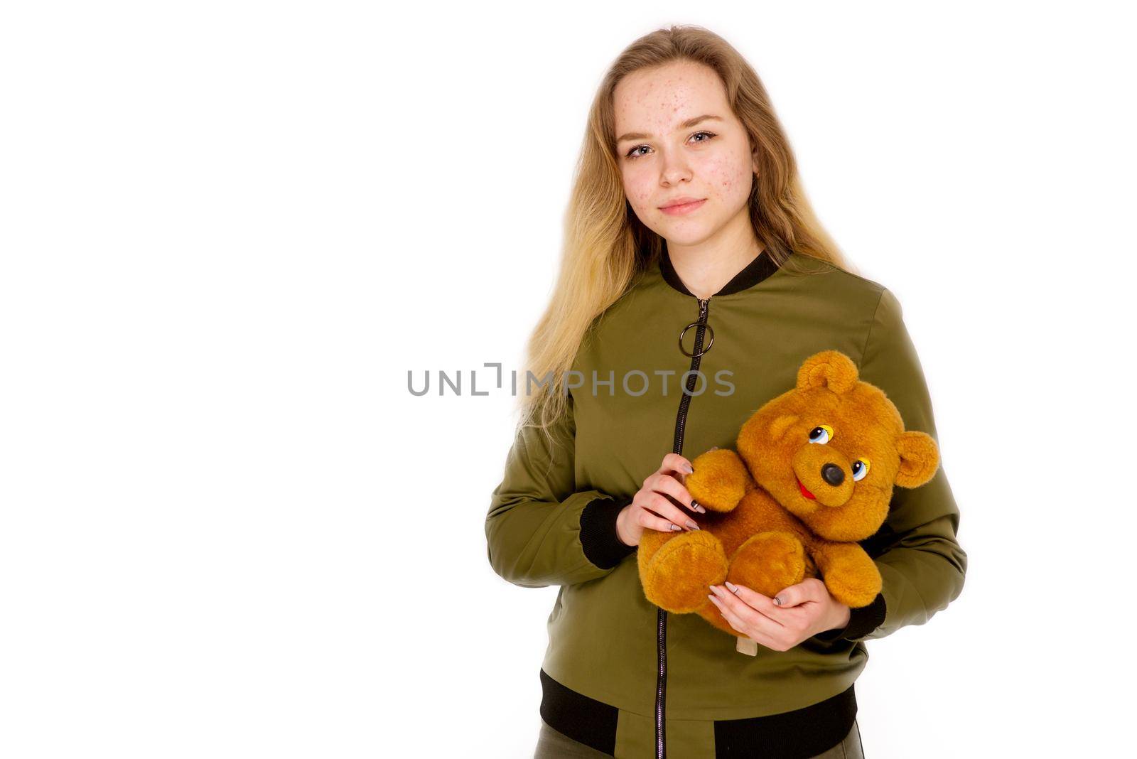 Portrait of a teenager teen girl with a teddy bear in her hands on a white background. Age of acne on face