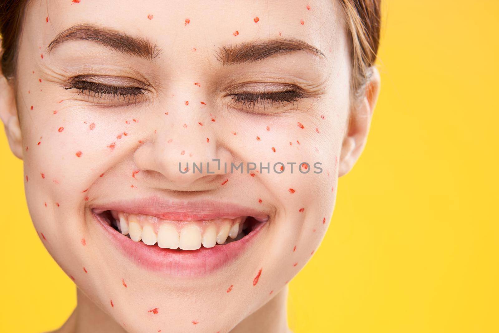 woman with red dots on her face skin problems dermatology dissatisfaction. High quality photo