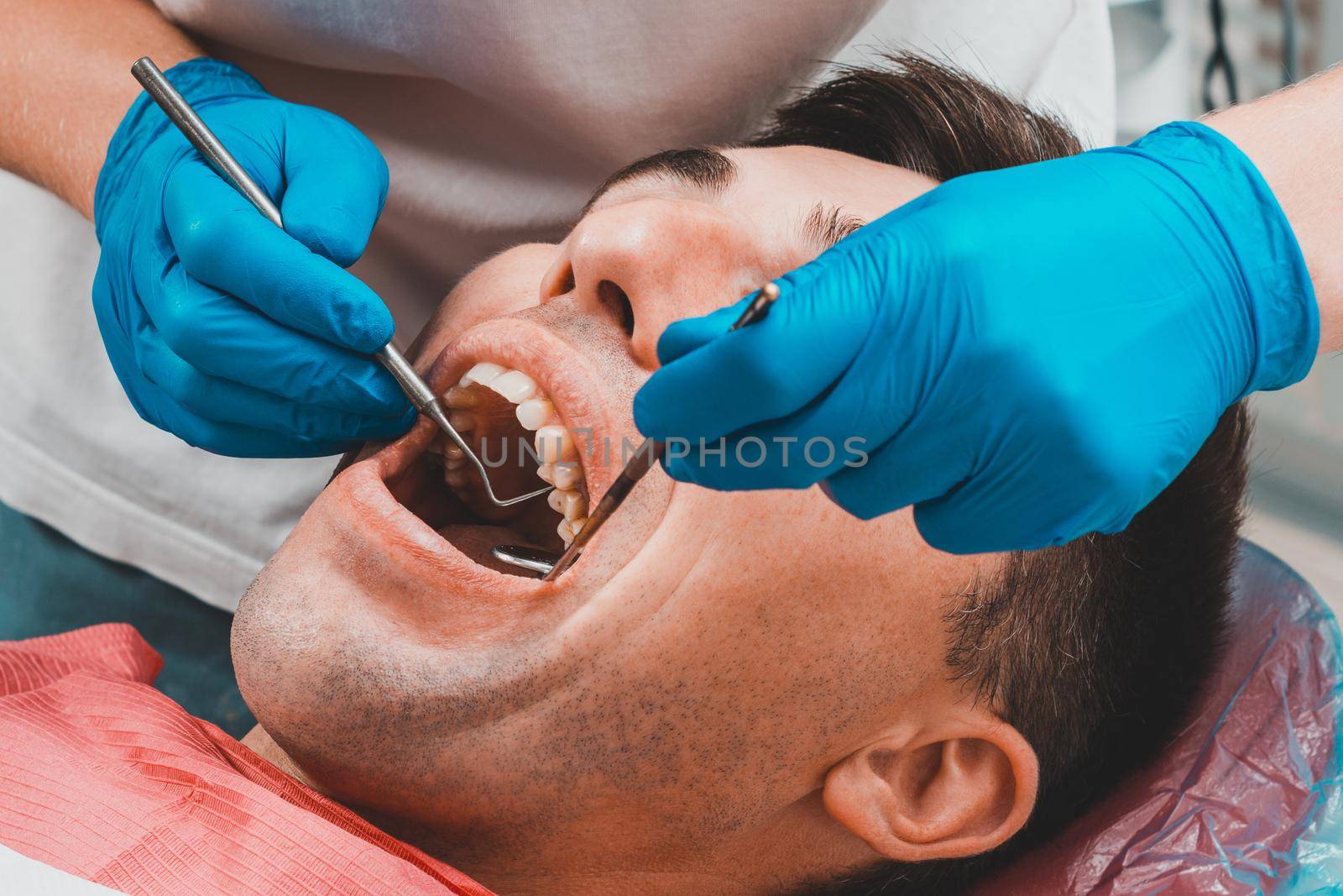 Dental clinic, the patient sits in a dental chair with his mouth wide open, the dentist assesses the condition of the teeth and makes a diagnosis. by Niko_Cingaryuk