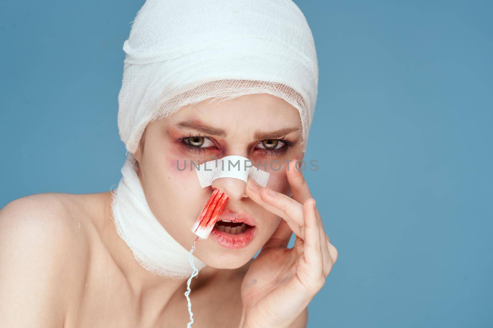 emotional woman bandaged face health problems studio lifestyle. High quality photo