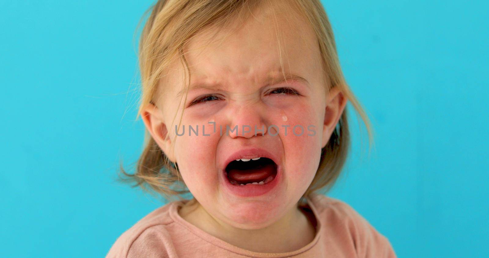 One-year-old baby girl cries blue background. Girl has milk teeth growing