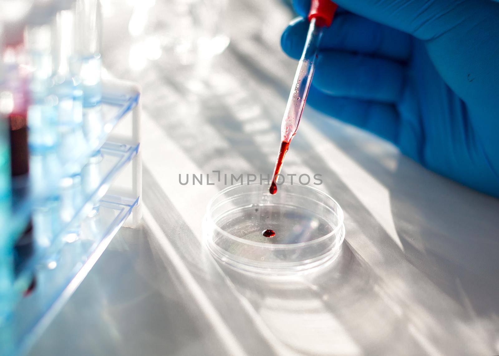 Close up photo of a researcher's hands in the laboratory is working on a vaccine against the virus. Drop of blood in a dropper