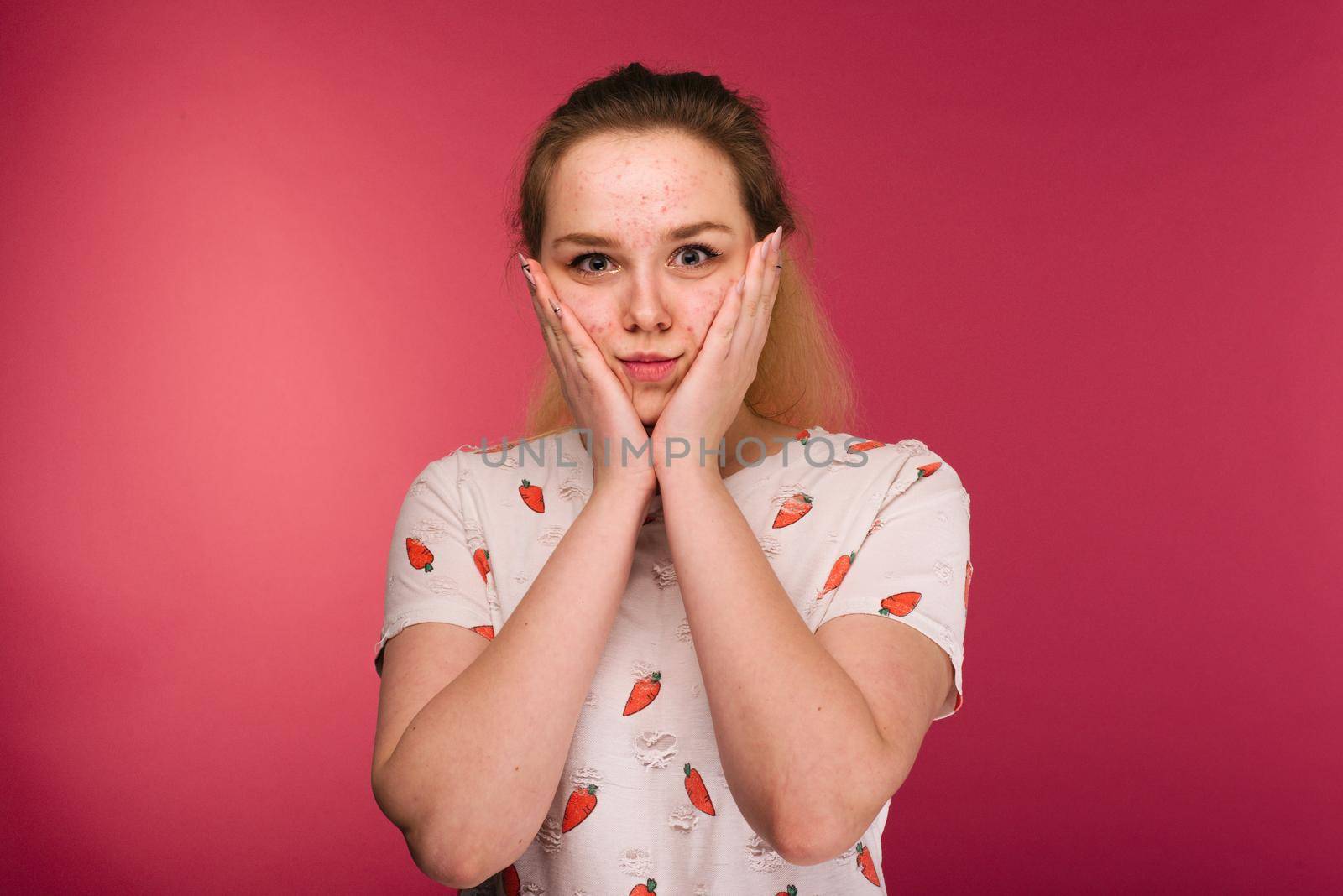 Portrait of teen girl touching her face and looking for acne on ruby background