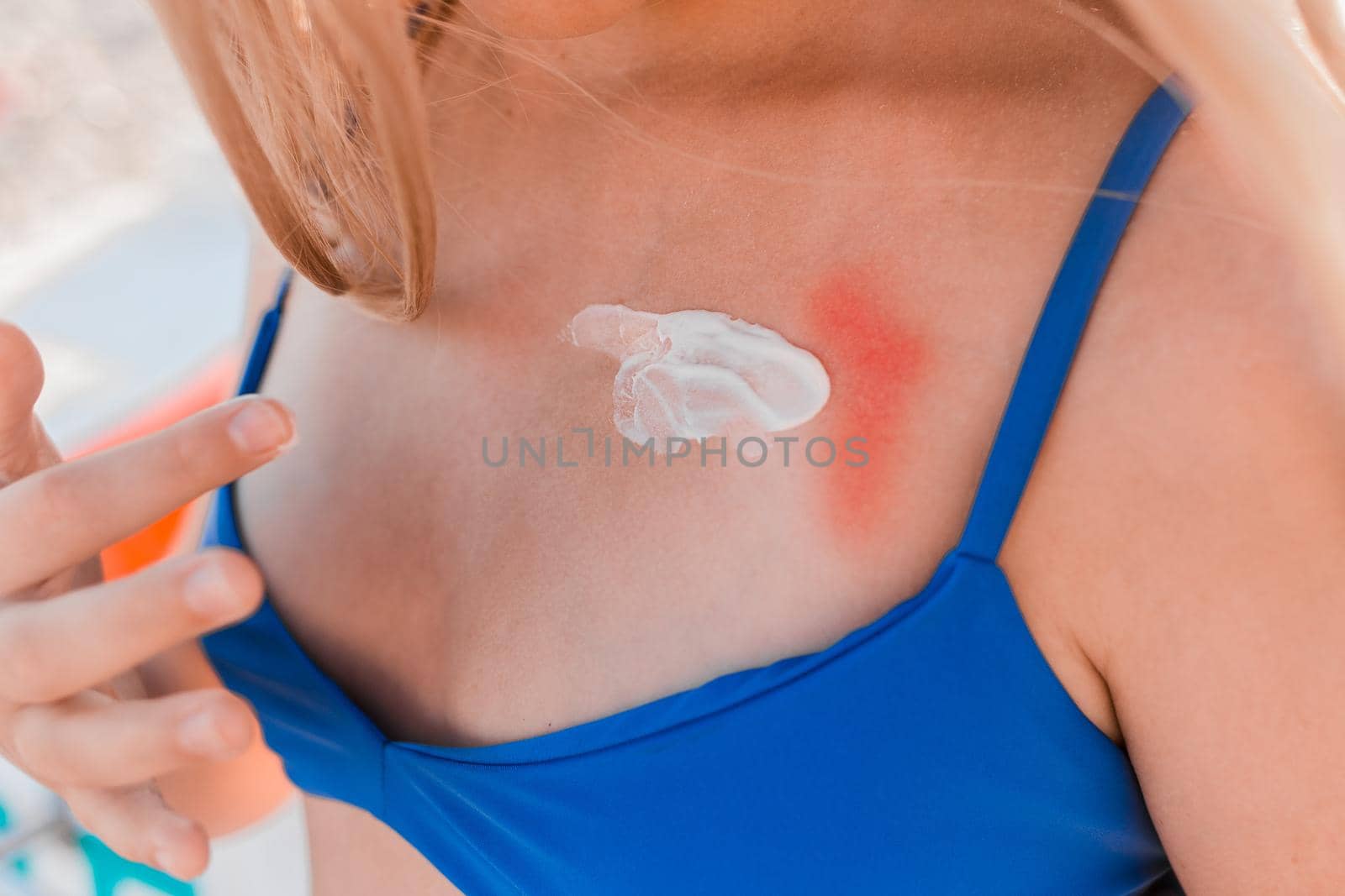 The hands of a young girl, in a blue swimsuit and shorts are going to smear on themselves a cream for sunbathing and protection from the sun against the background of the beach by AYDO8