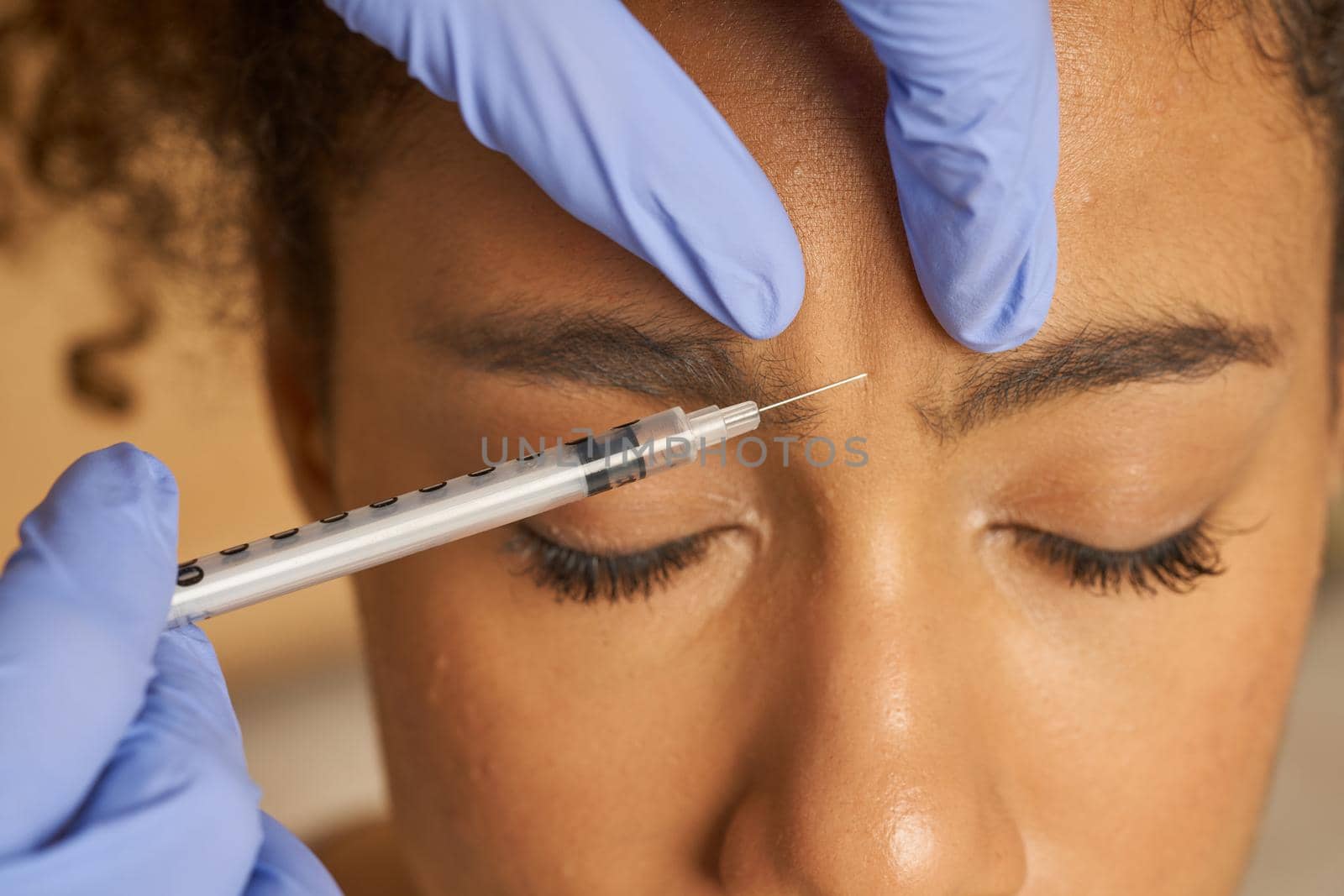 Close up shot of cosmetic injection to the pretty young female face isolated over beige background. Beauty, cosmetology concept. Horizontal shot