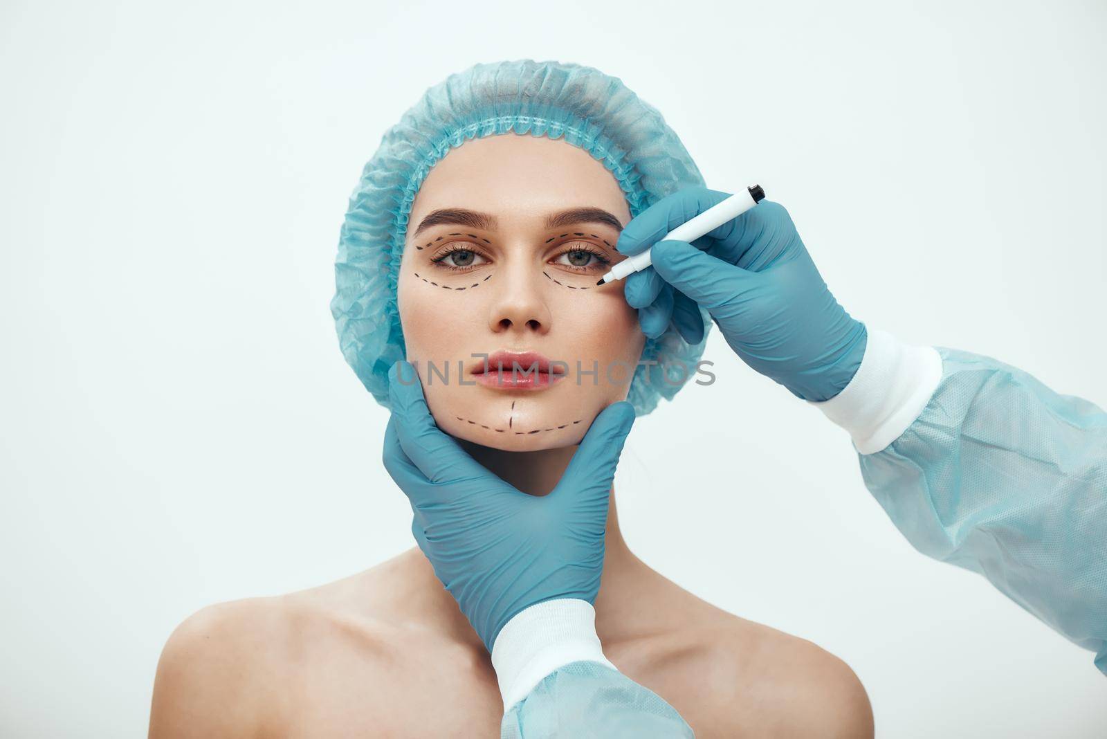 Perfect face. Beautiful and young woman in blue medical hat waiting for facial surgery while plastic surgeon in blue gloves drawing dashed lines on her face by friendsstock