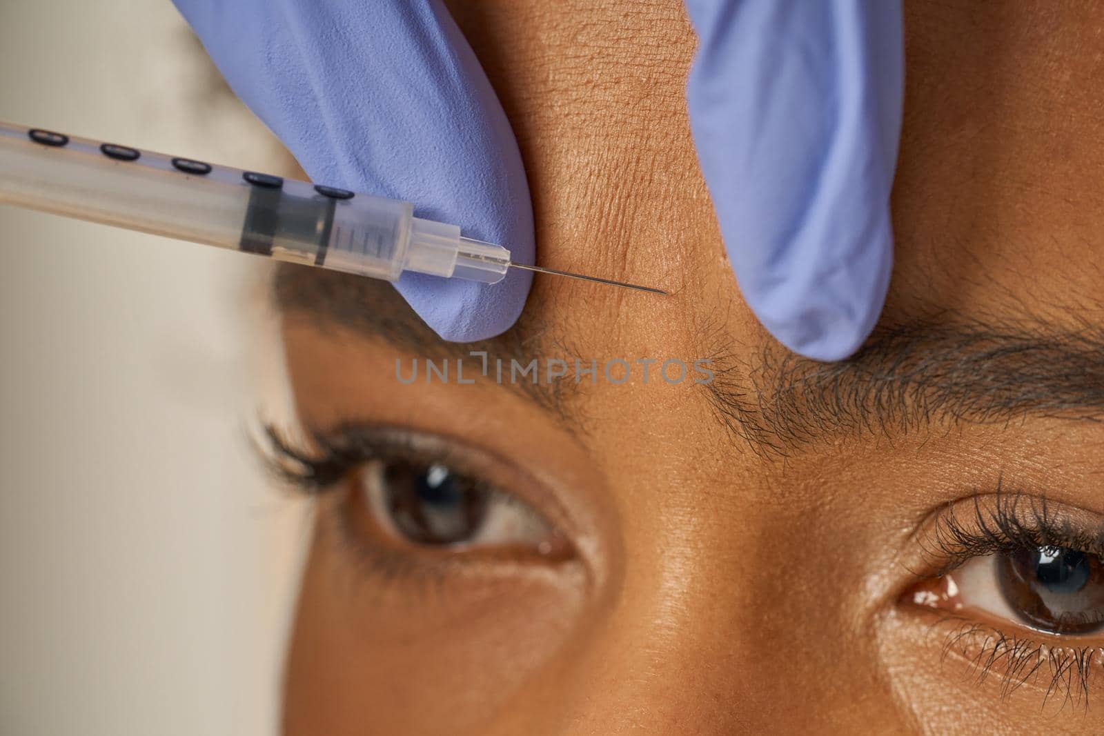 Close up portrait of beautiful young woman gets face injections isolated over beige background. Beauty, cosmetology concept