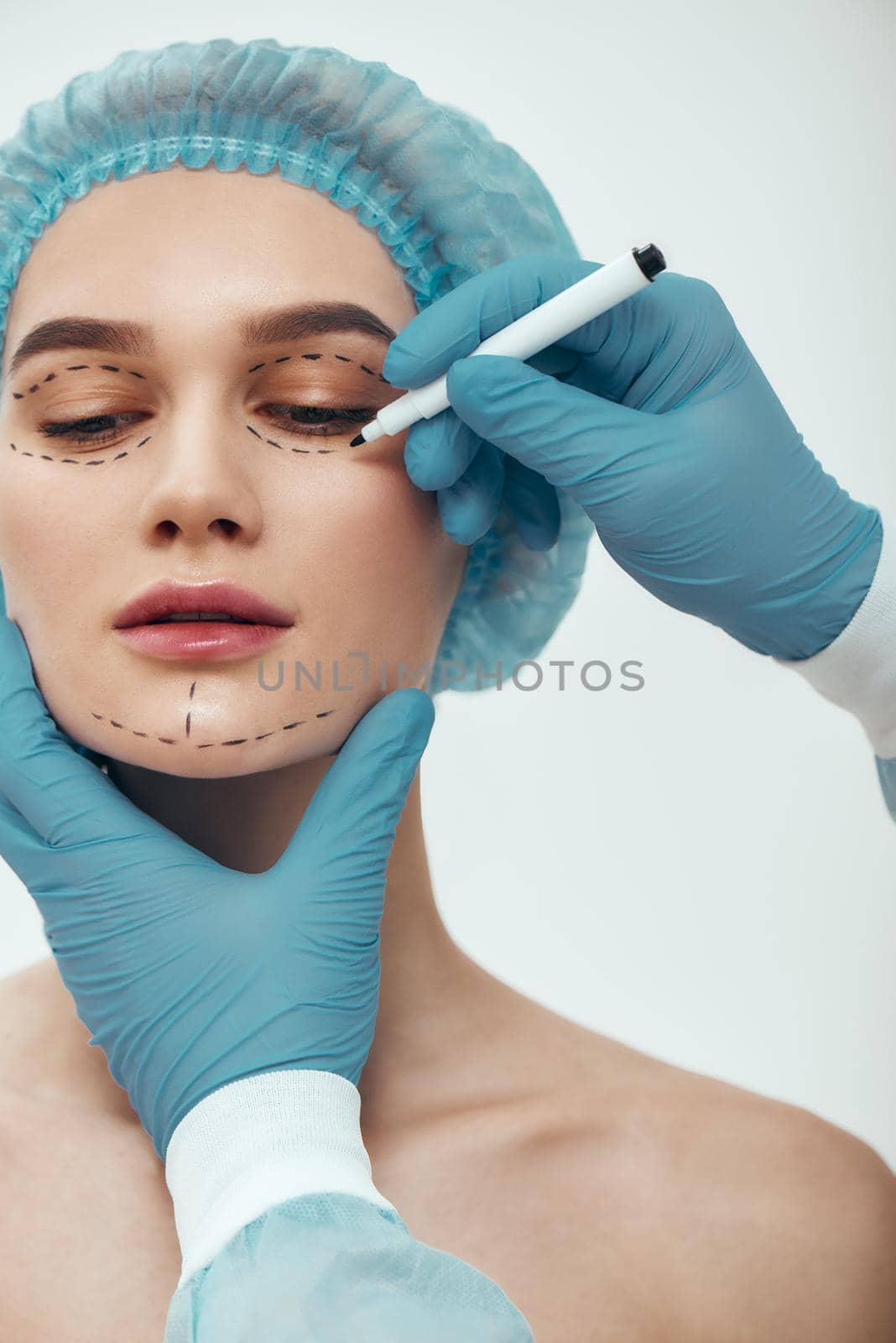 Beautiful patient. Young woman in blue medical hat waiting for facial surgery while plastic surgeon in blue gloves drawing dashed lines on her face by friendsstock