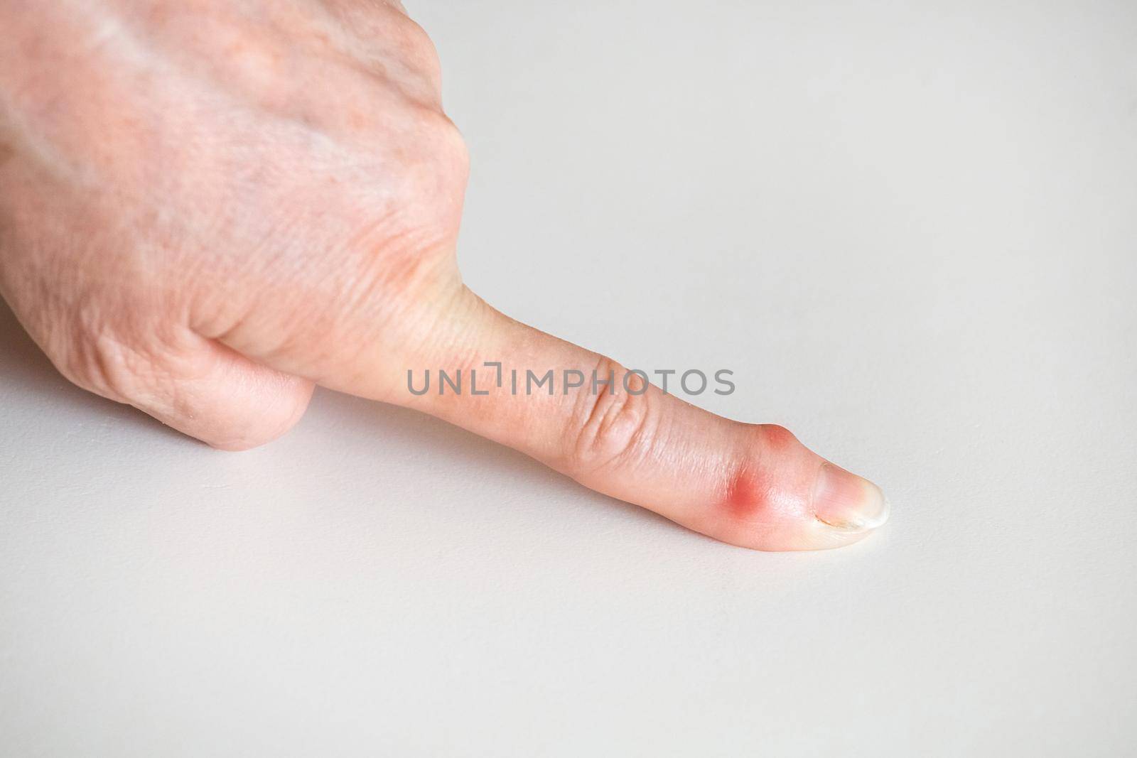 Sick female fingers of an elderly man's hands on a white background.