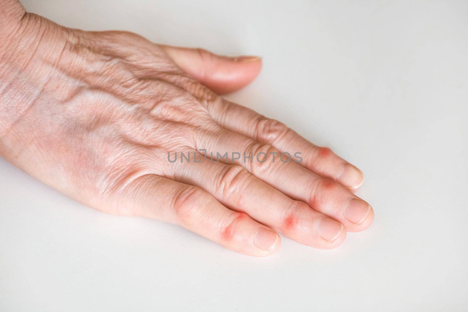 Sick female fingers of an elderly man's hand on a white background.