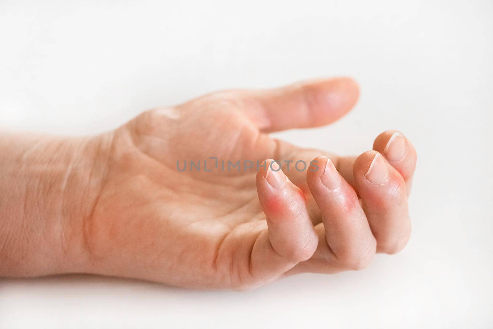 Sick female fingers of an elderly man's hand on a white background.