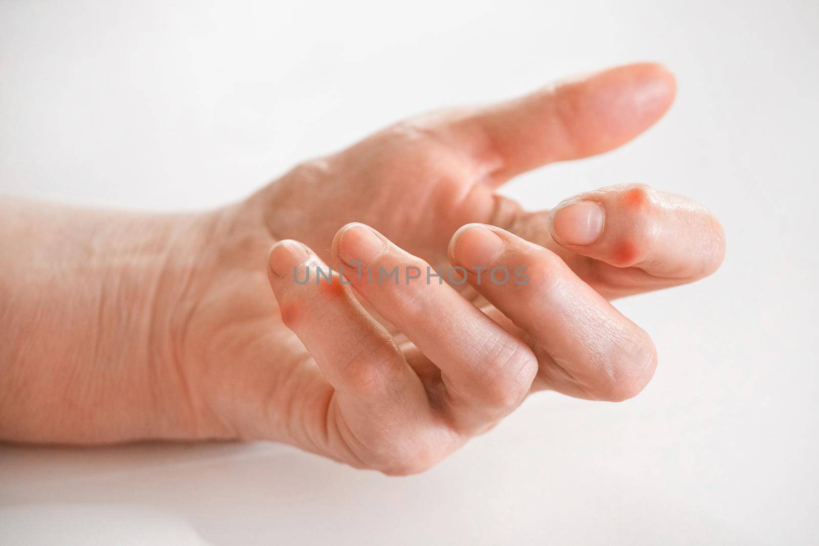 Sick female fingers of an elderly man's hand on a white background.