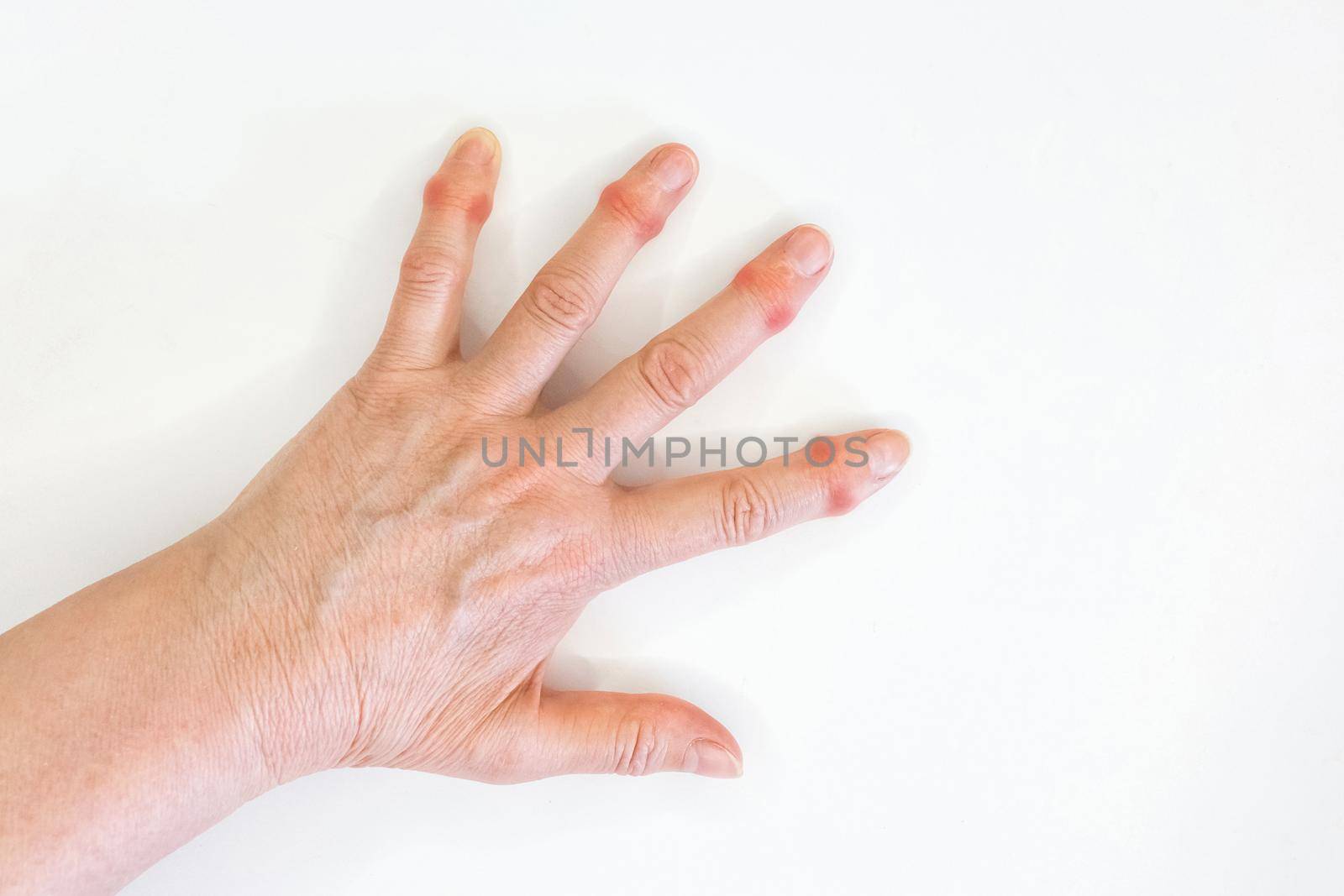 Hand of an old woman with sore fingers on a white background.