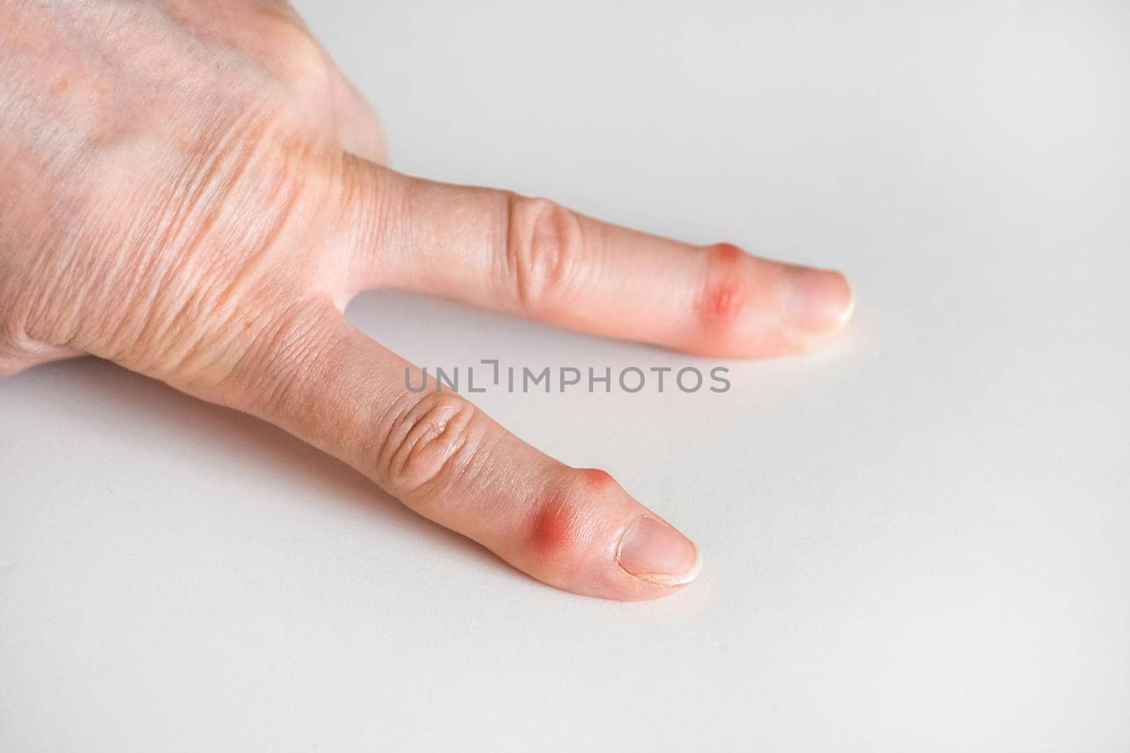 Sick female fingers of an elderly man's hand on a white background.