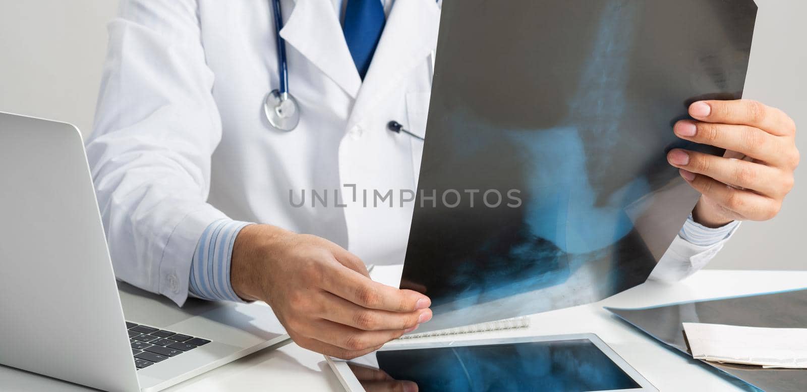Close up of male doctor hands holding x-ray scan. Physician with stethoscope examining x-ray image. Professional medical diagnosis and treatment in hospital. Medical testing and radiography expertise.