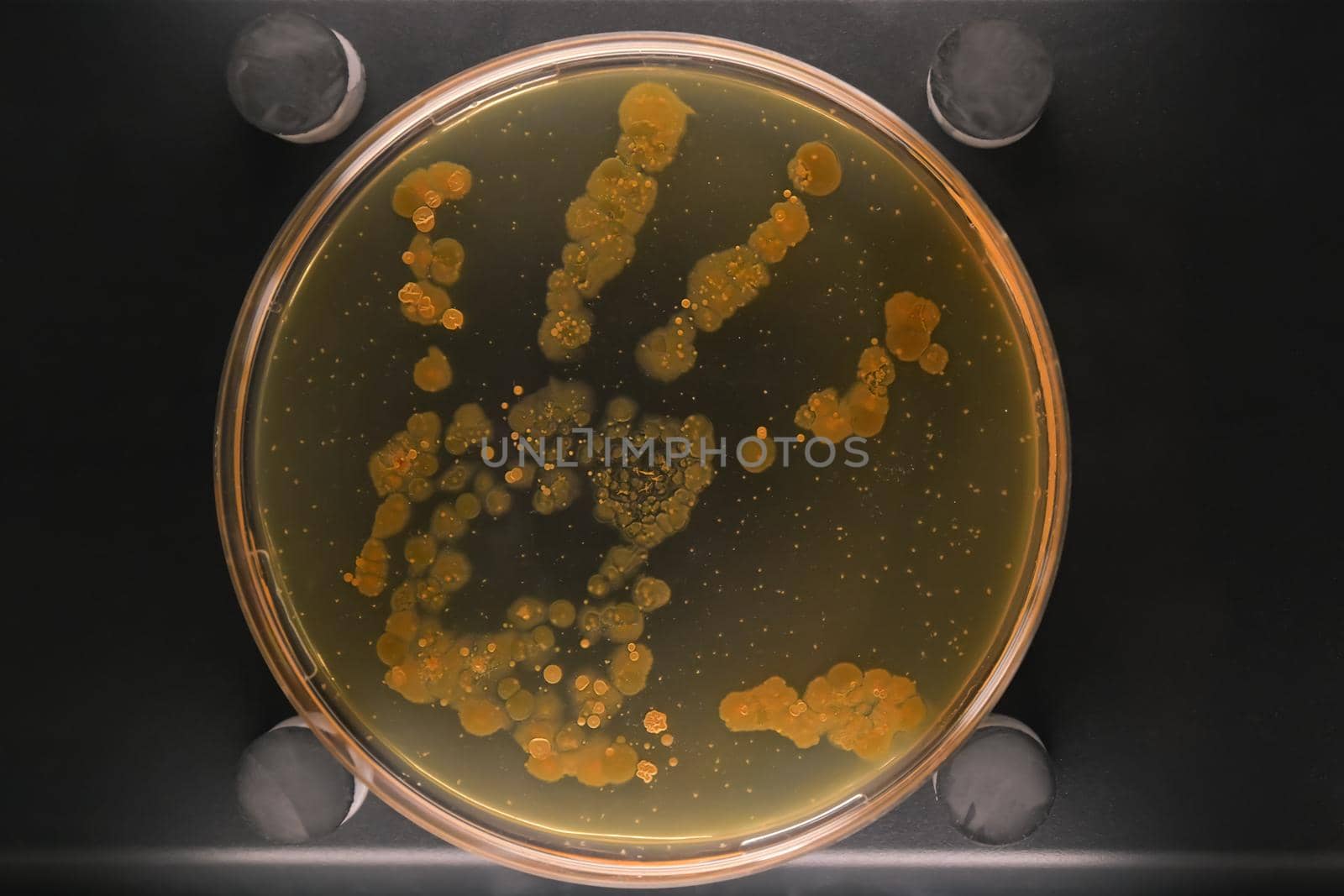 Petri dish with a colony of bacteria on a hand