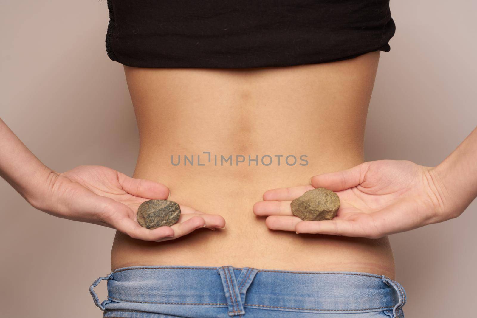 kidney stones poor metabolism anatomy health problems patient. High quality photo