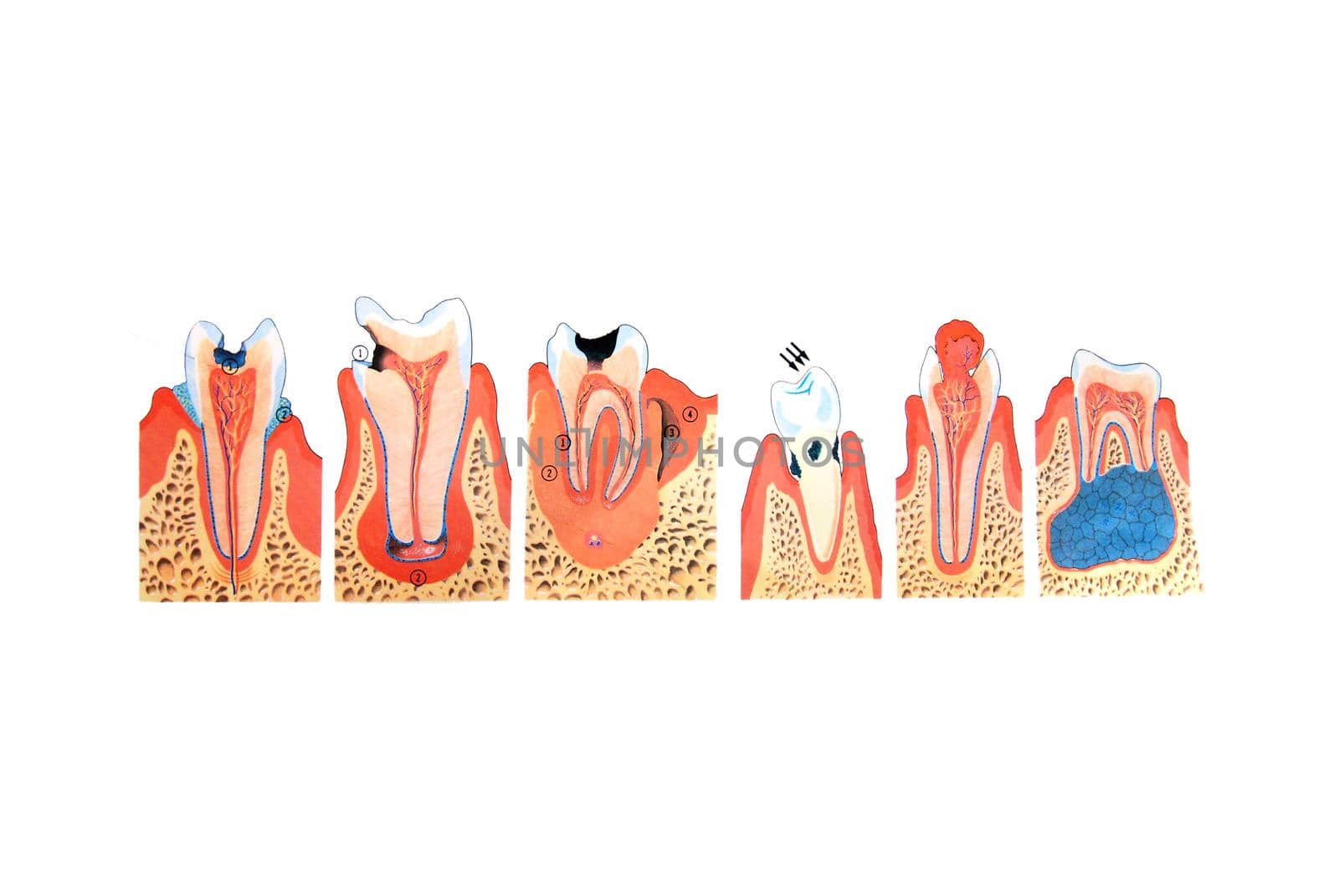 teeth illustration by dotshock