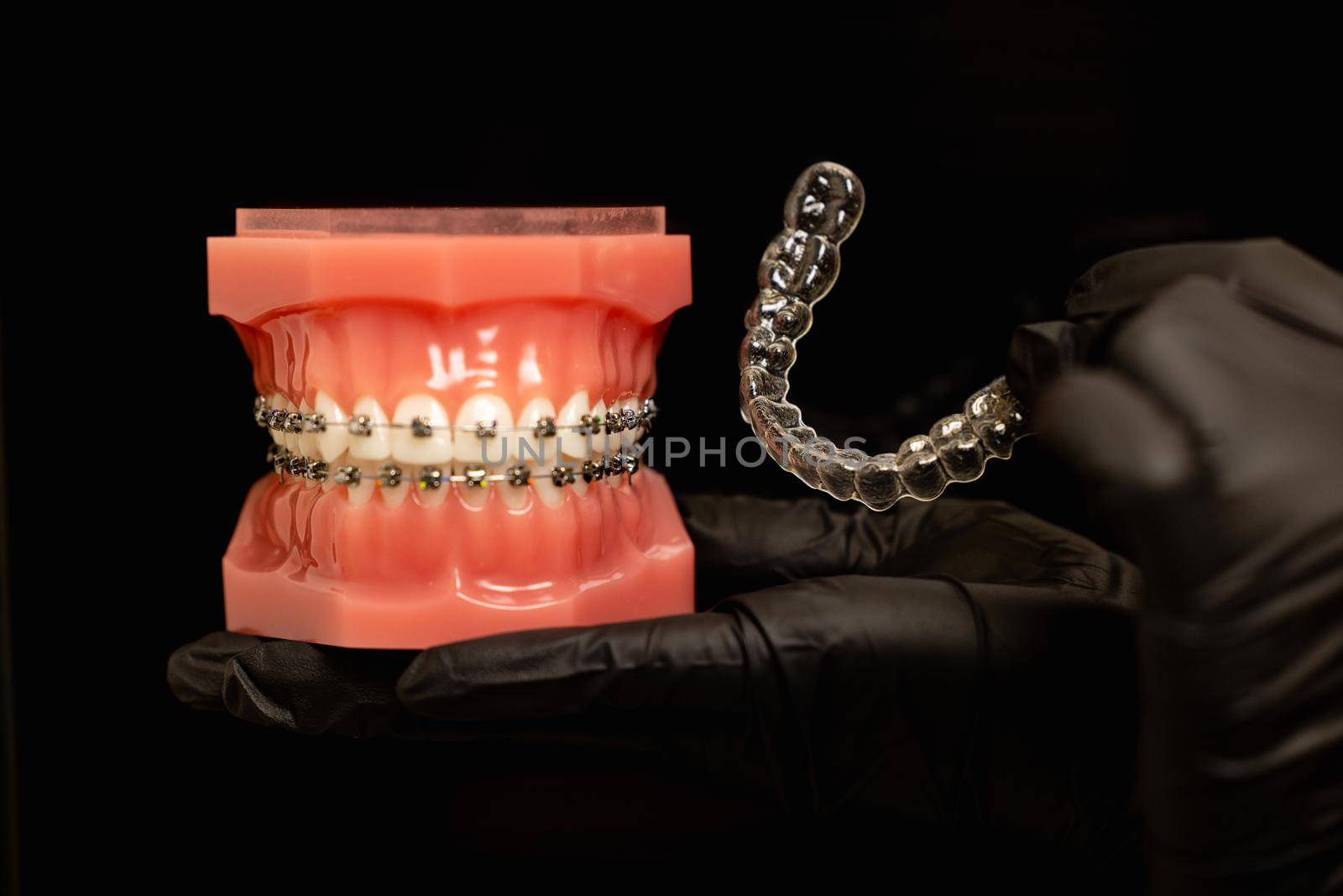 mouth guard and models of teeth with braces on teeth on a jaw by yulikov