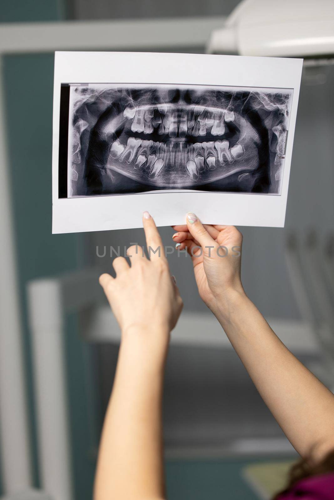Beautiful woman doctor with dental scans in hands in a dental clinic by yulikov