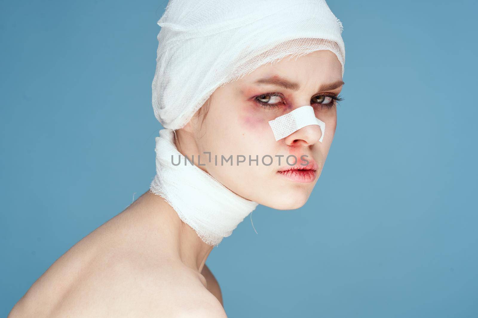 female patient bandaged face bruises bare shoulders discontent blue ...