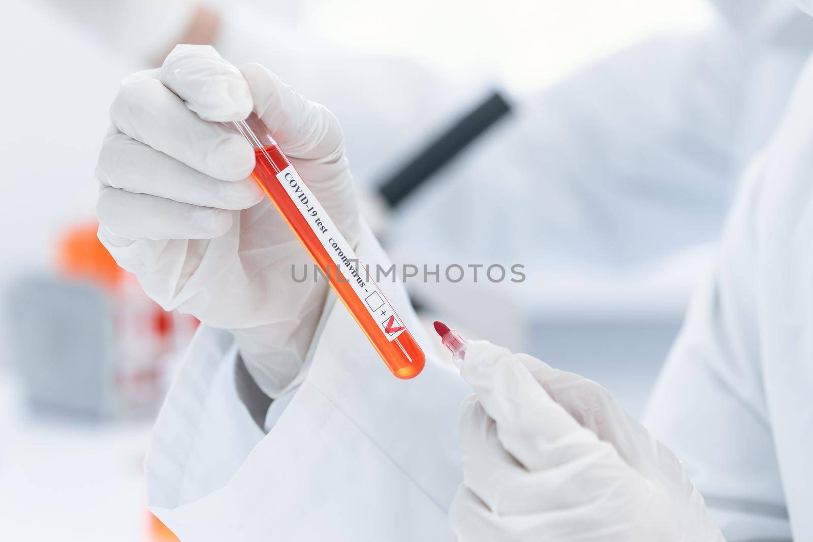 close up. tube with a tested test in the hands of a laboratory employee. photo with a copy-space.