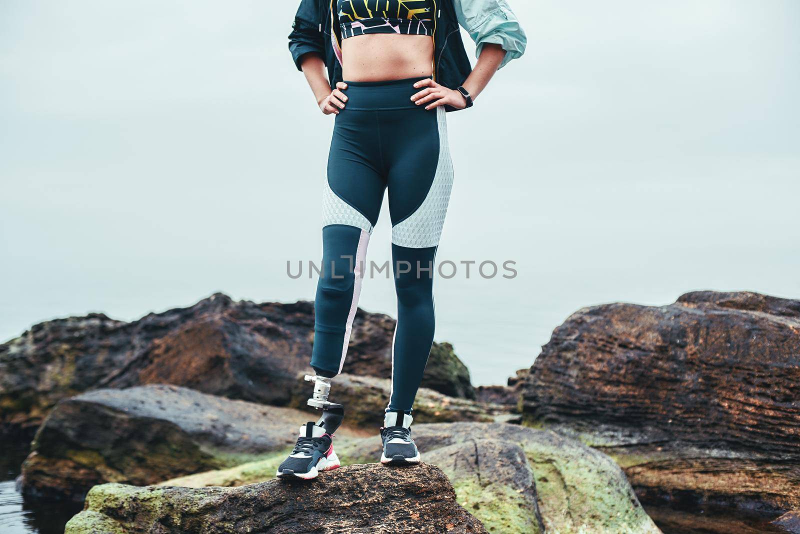Cropped photo of disabled woman in sports clothing with prosthetic leg standing on the stone and keeping arms on her hips. by friendsstock