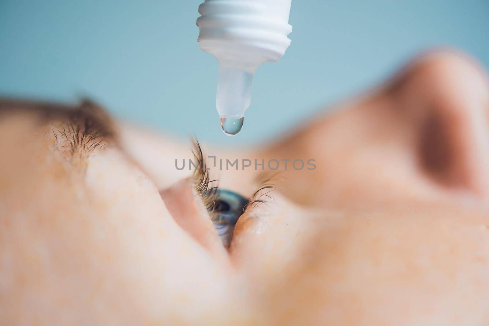 Closeup of eyedropper putting liquid into open eye.