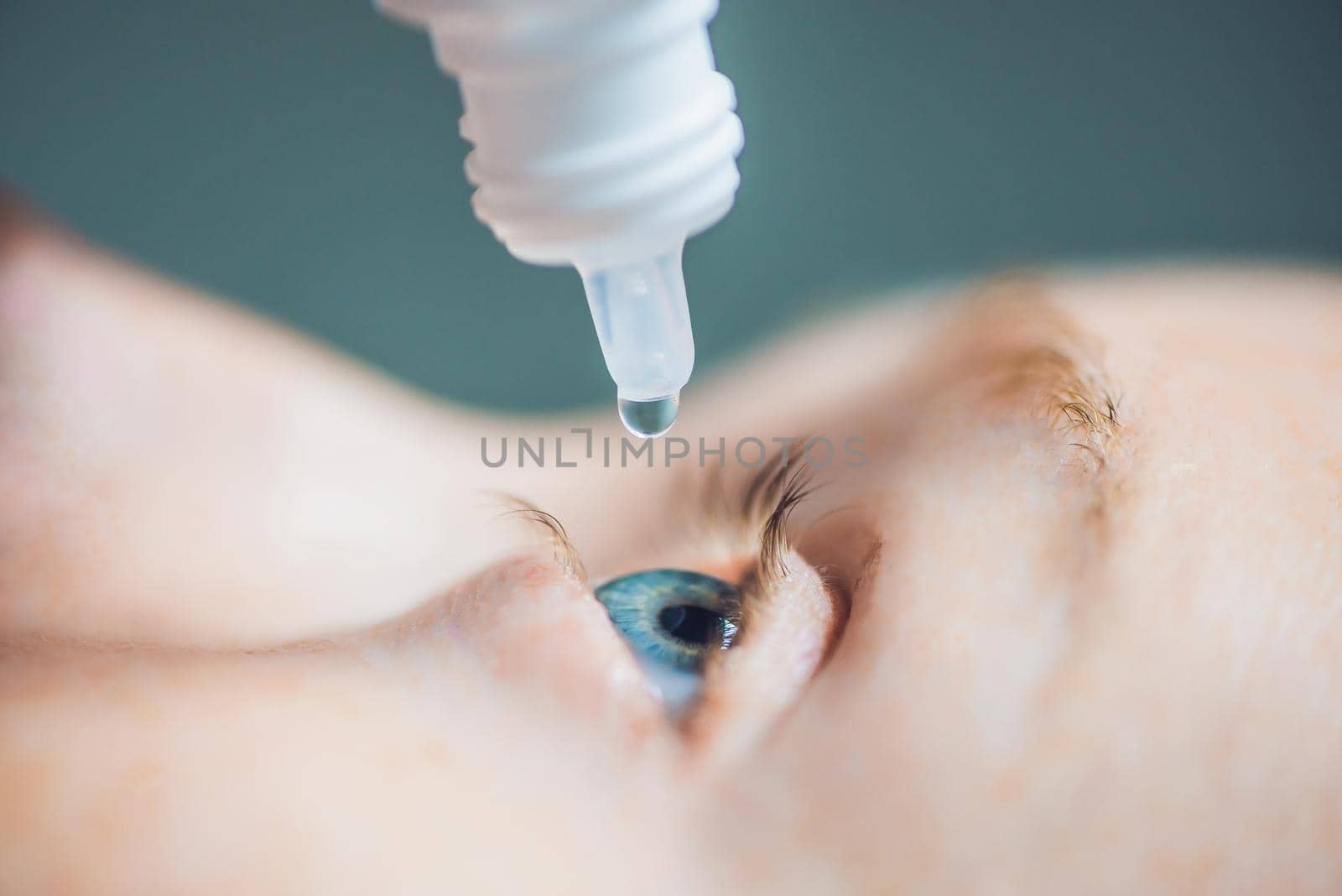 Closeup of eyedropper putting liquid into open eye.
