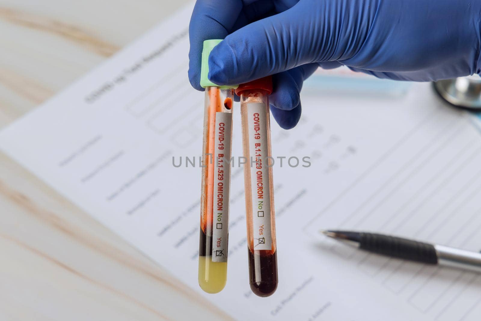 Test to detect new version Omicron COVID-19 coronavirus in patient samples blood tested positive