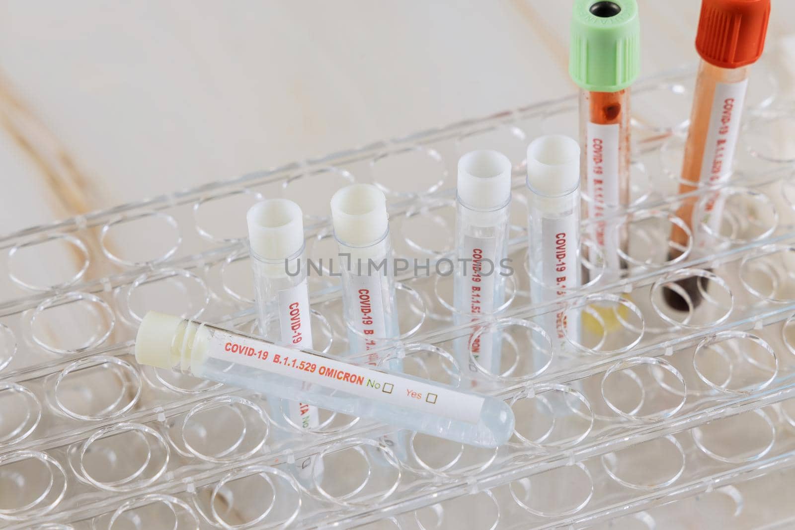 Diagnostic testing for COVID-19 new version Omicron laboratory test in hospital lab medical science professional taking sample test tube